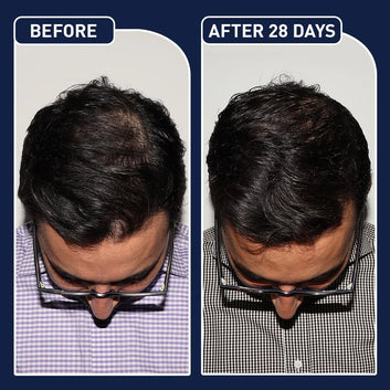 FEG Plus Hair Growth Spray / بخاخ نمو الشعر FEG Plus